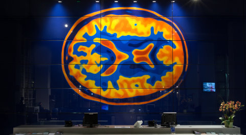 Image of brain at College entrance