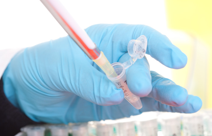 Pipette