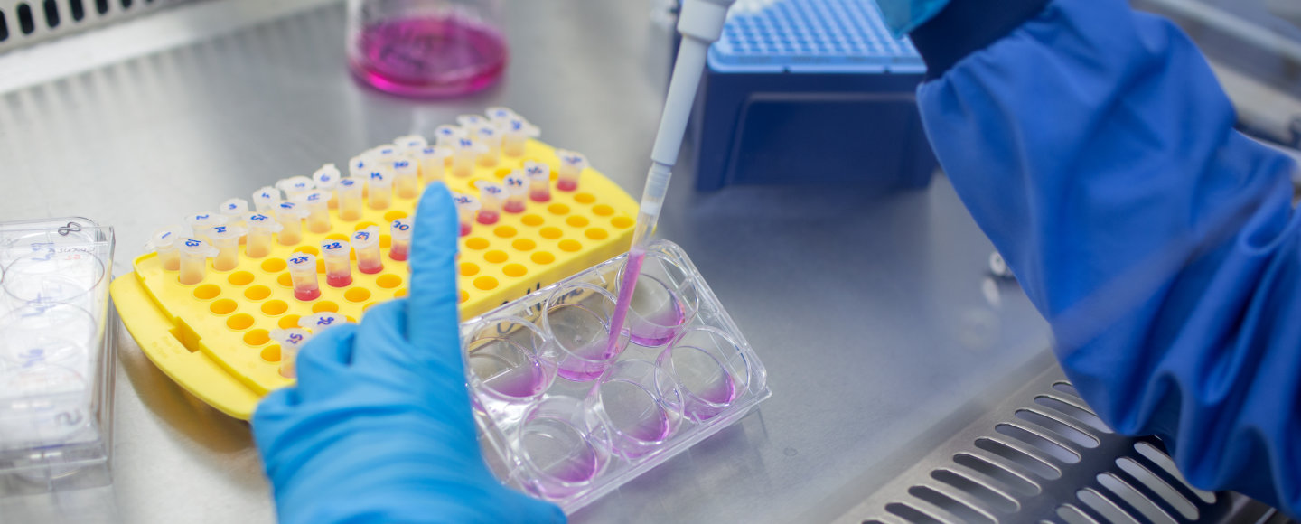 Labwork
