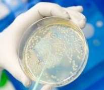 Microorganism