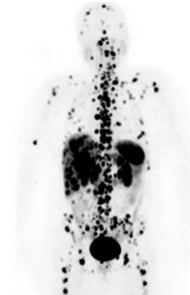 body scan image